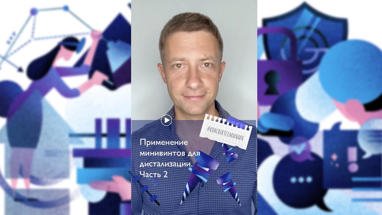 6. Применение минивинтов для дистализации. Часть 2 | #конспектсеминара_MV