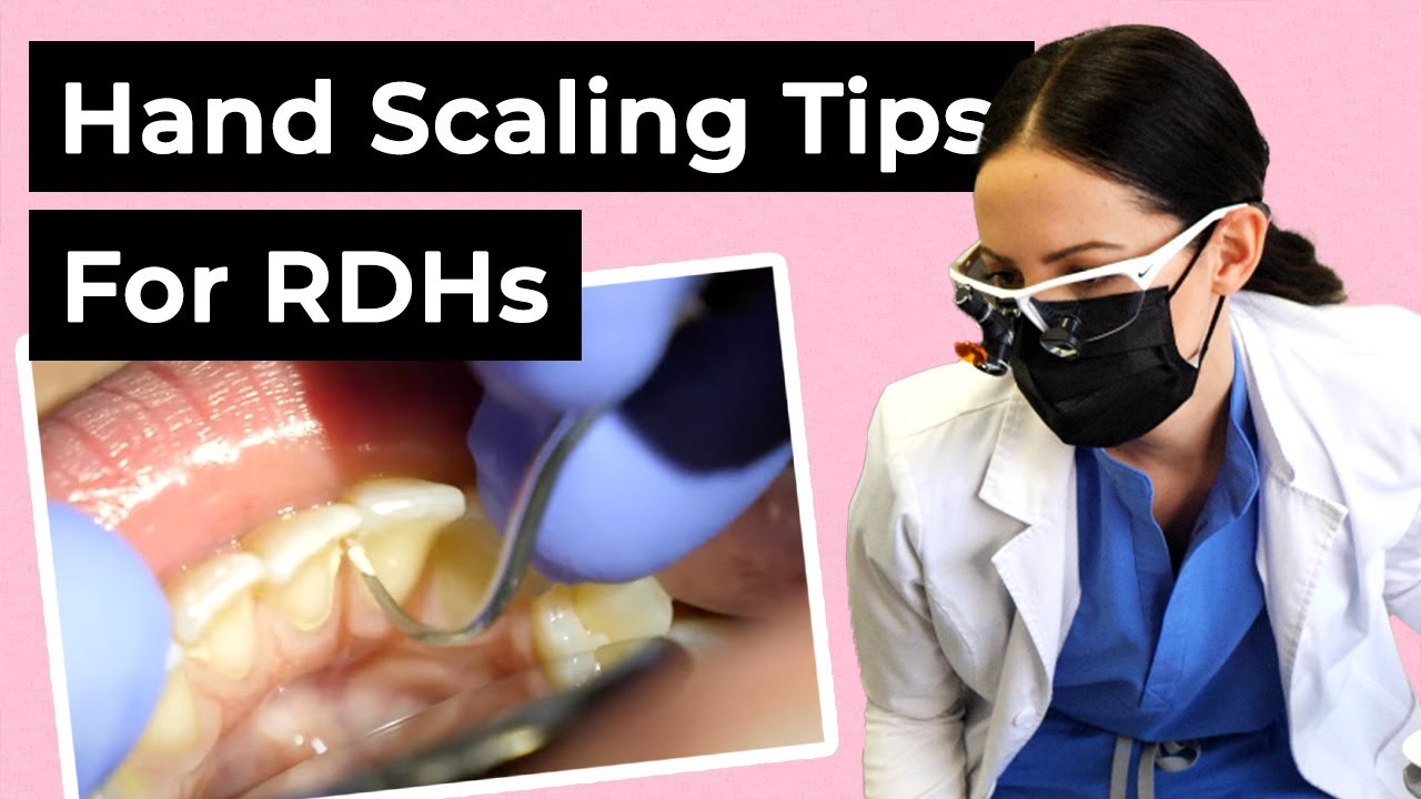 Hand Scaling Tips for Hygienists (Dental Cleaning)