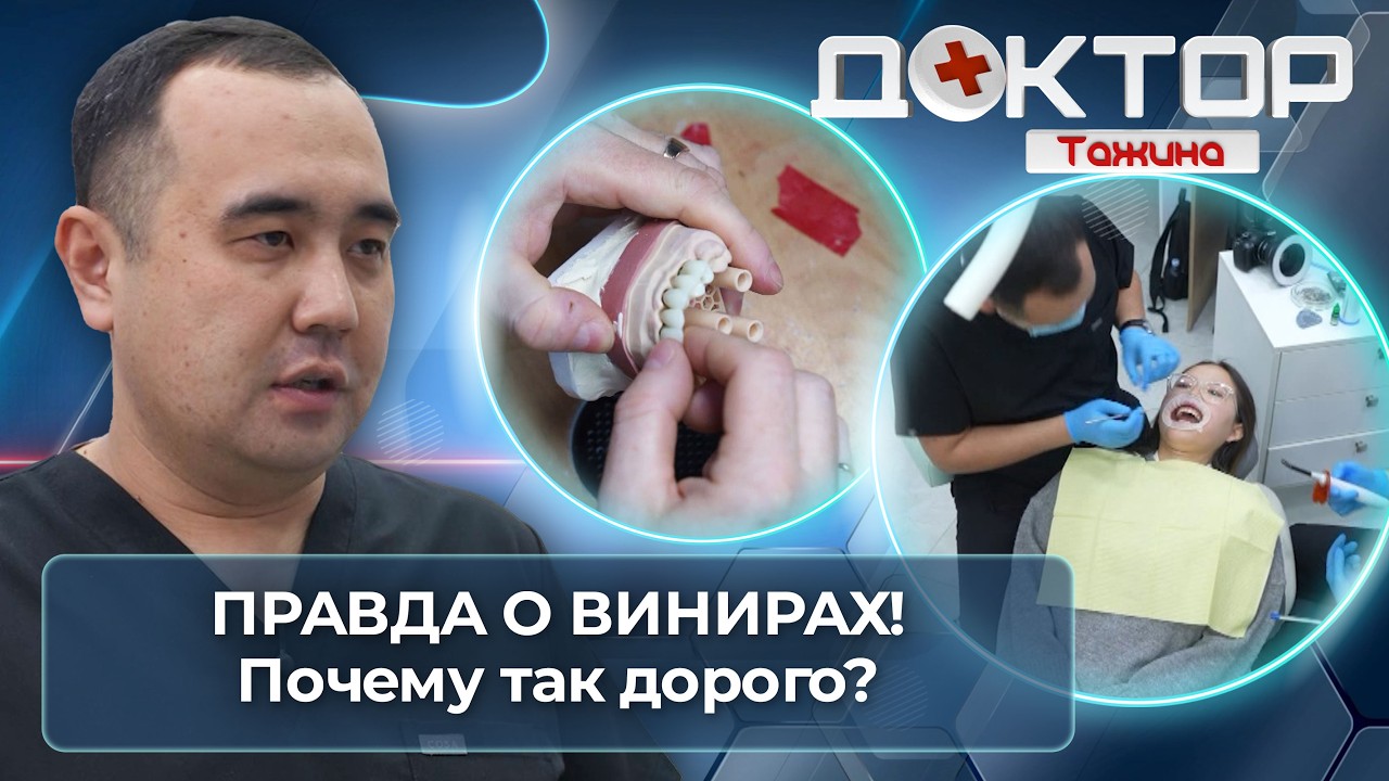 Вся правда о винирах: показания, цена, противопоказания и советы врача