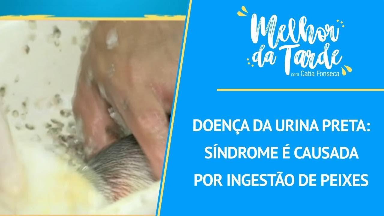 Doen&ccedil;a da urina preta: s&iacute;ndrome &eacute; causada por ingest&atilde;o de peixes | MELHOR DA TARDE