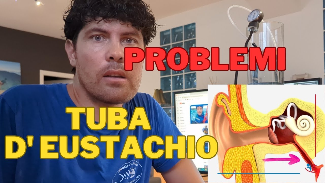 Come ho risolto i problemi di COMPENSAZIONE