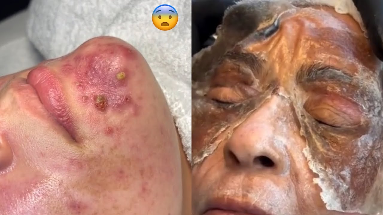 Most Extreme Beauty Treatments 2024 Best Smart and Helpful Beauty Hacks | Virtual Beauty