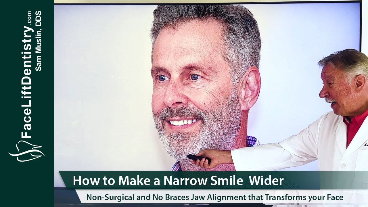 Narrow Smile Correction with Non-Invasive VENLAY® Restorations