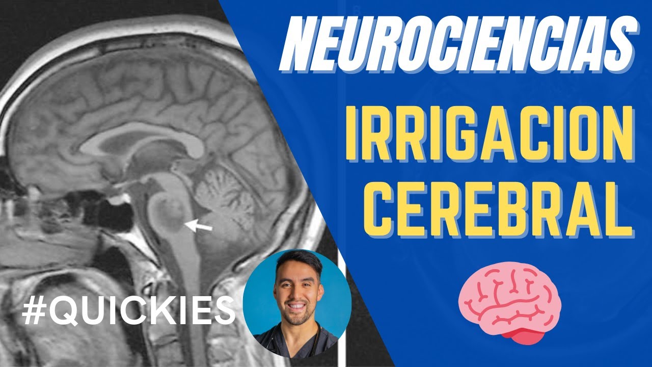 CIRCULACIÓN CEREBRAL: UN RESUMEN, POLÍGONO DE WILLIS!!!