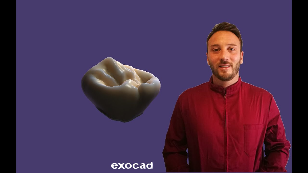 EXOCAD Progettazione elemento in zirconio da impronta digitale