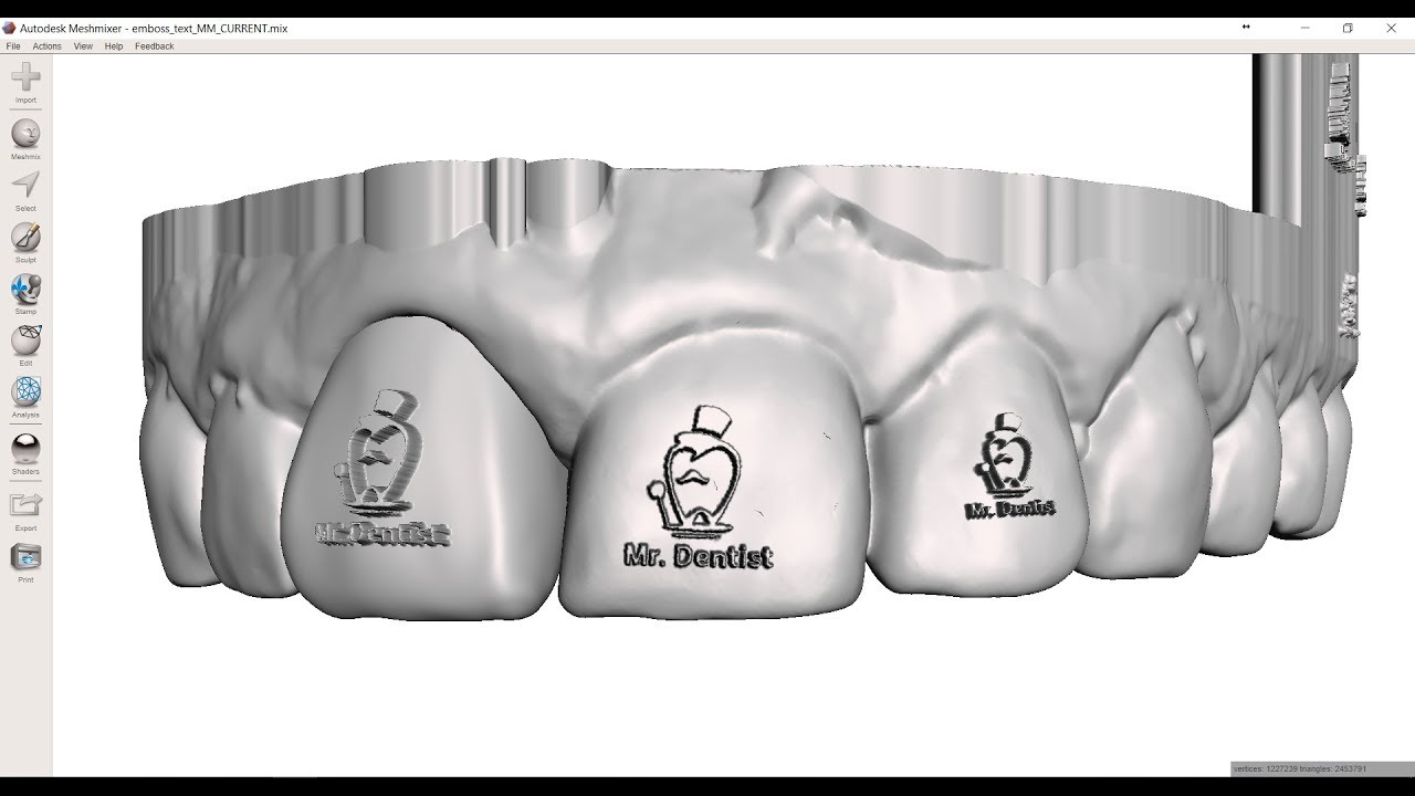 Embossing High Resolution Images (Brand Logos) on Dental Models