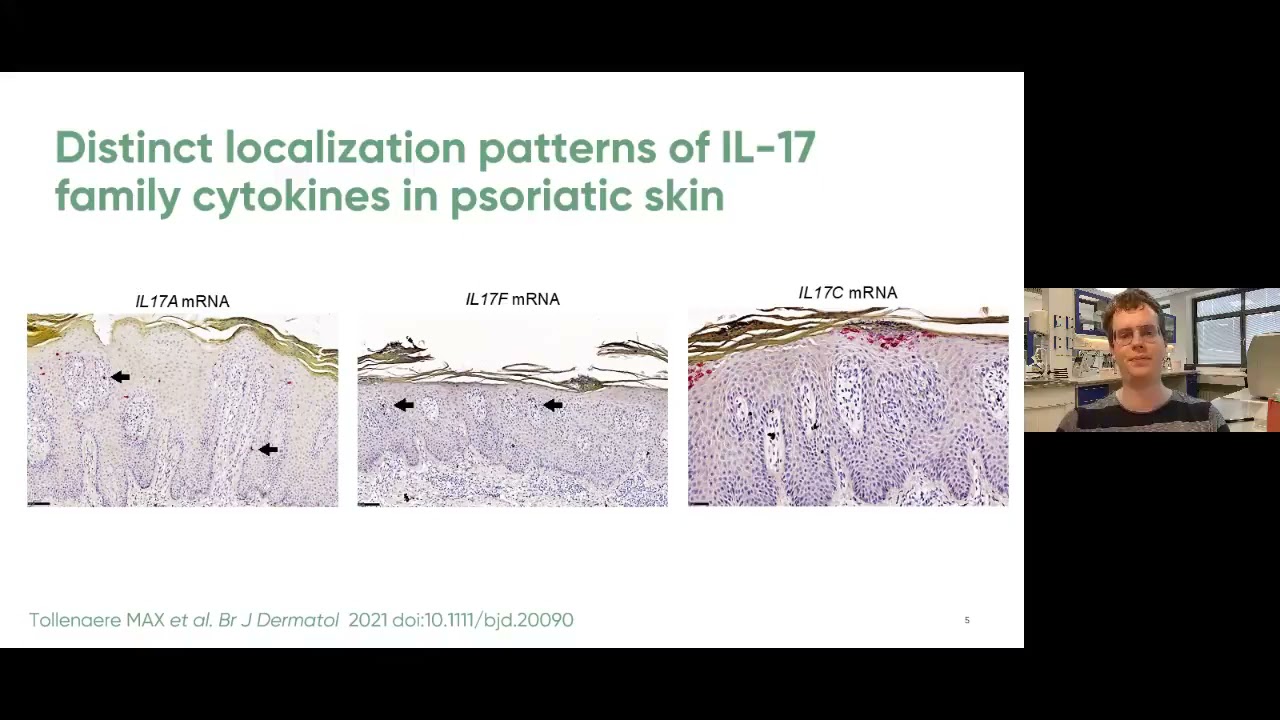 IL-17 family cytokines involved in psoriasis, M.A.X. Tollenaere et al