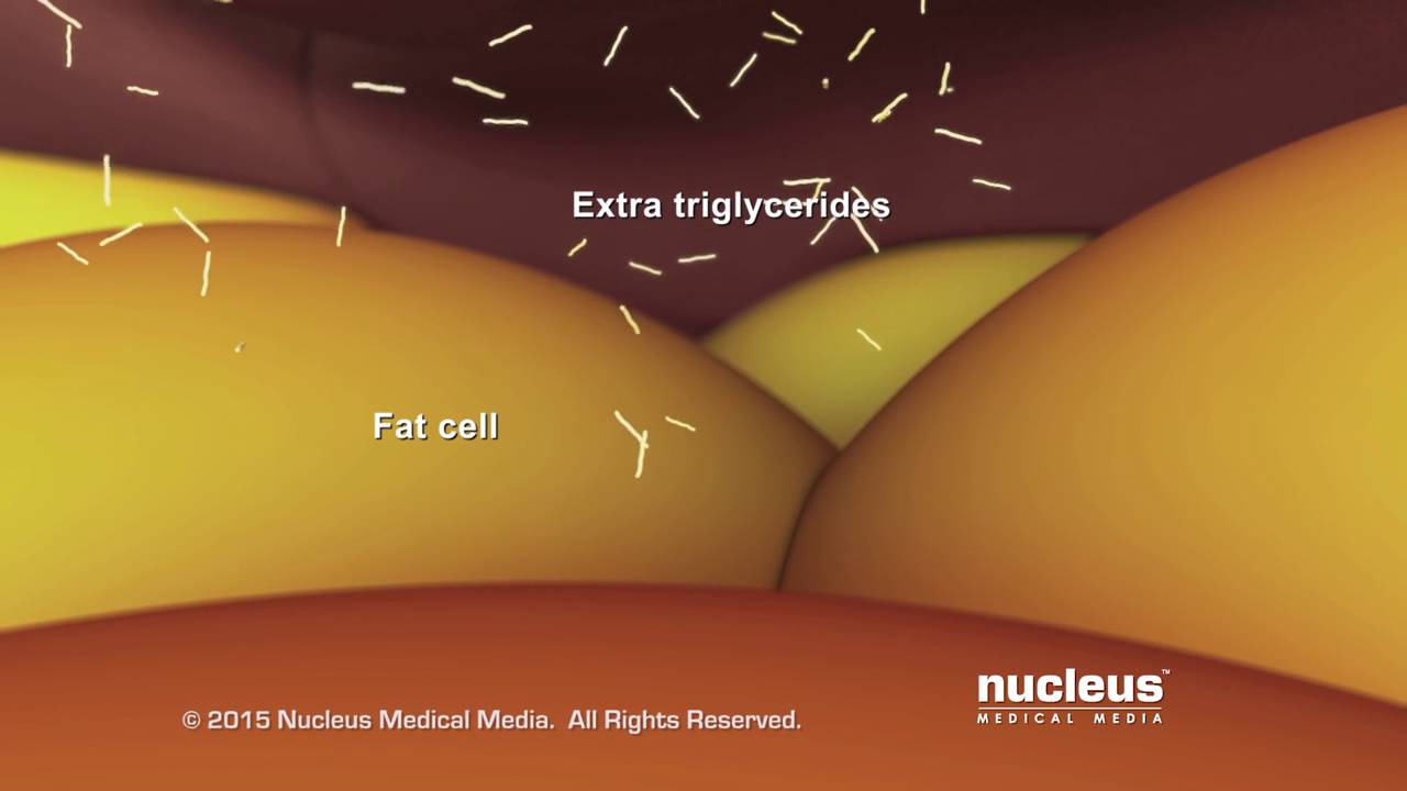 Asian Heart Hospital - What is Triglycerides?
