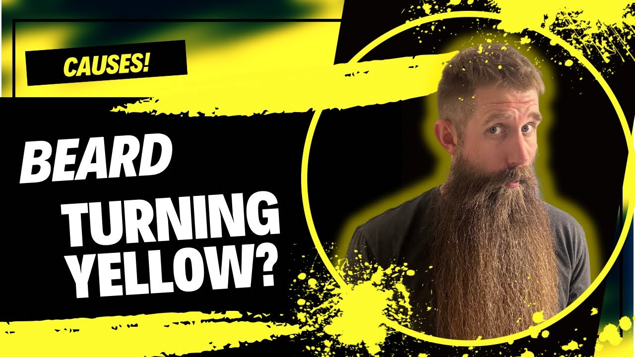 Why Do Beards Turn Yellow!?