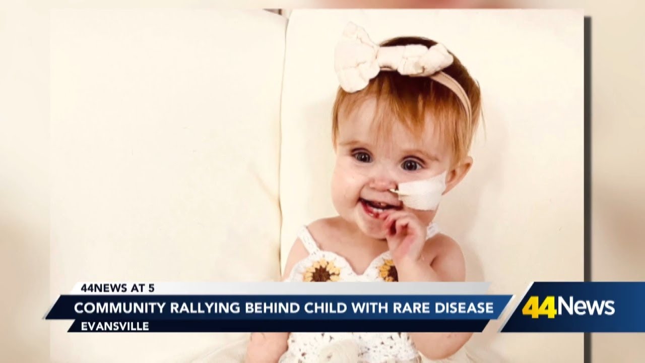 Community rallying behind child with rare disease