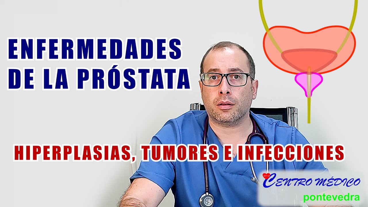 La Próstata y sus enfermedades
