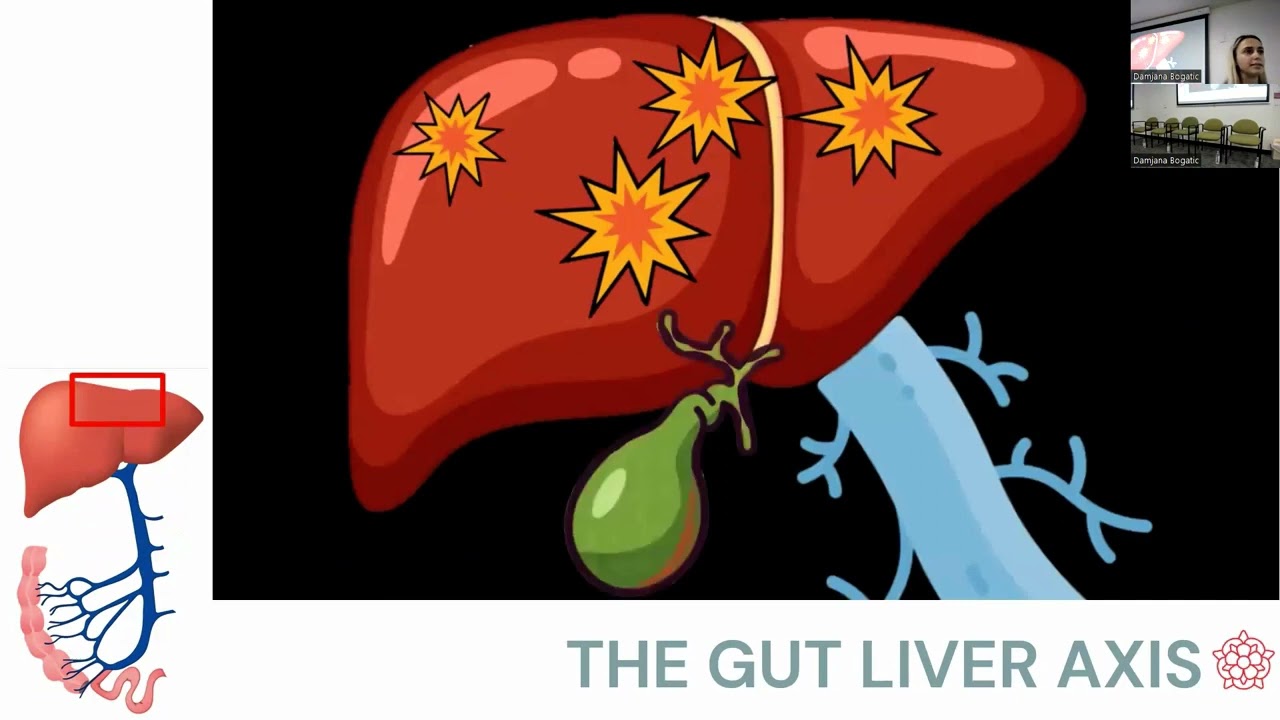 Manipulation of the gut microbiome as therapy for PSC (Dr. Damjana Bogatic)