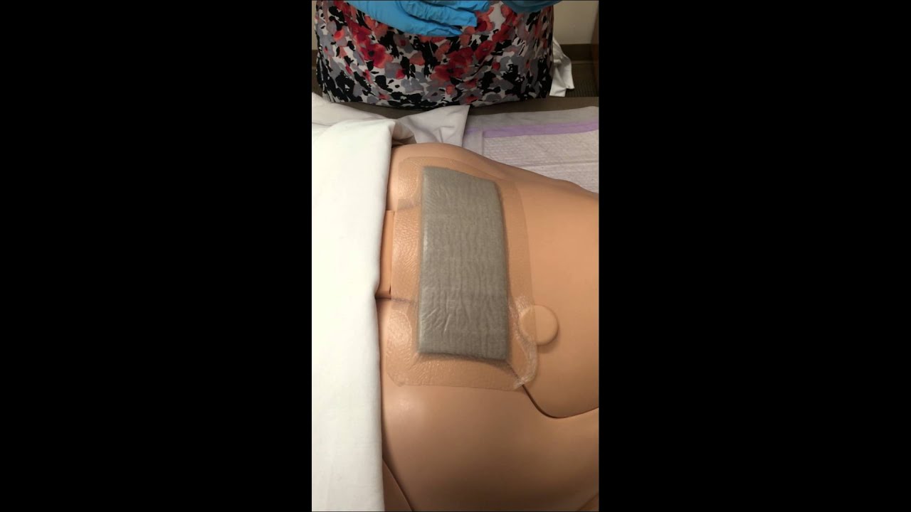 Mepilex Ag Borderline Dressing Clinical Education