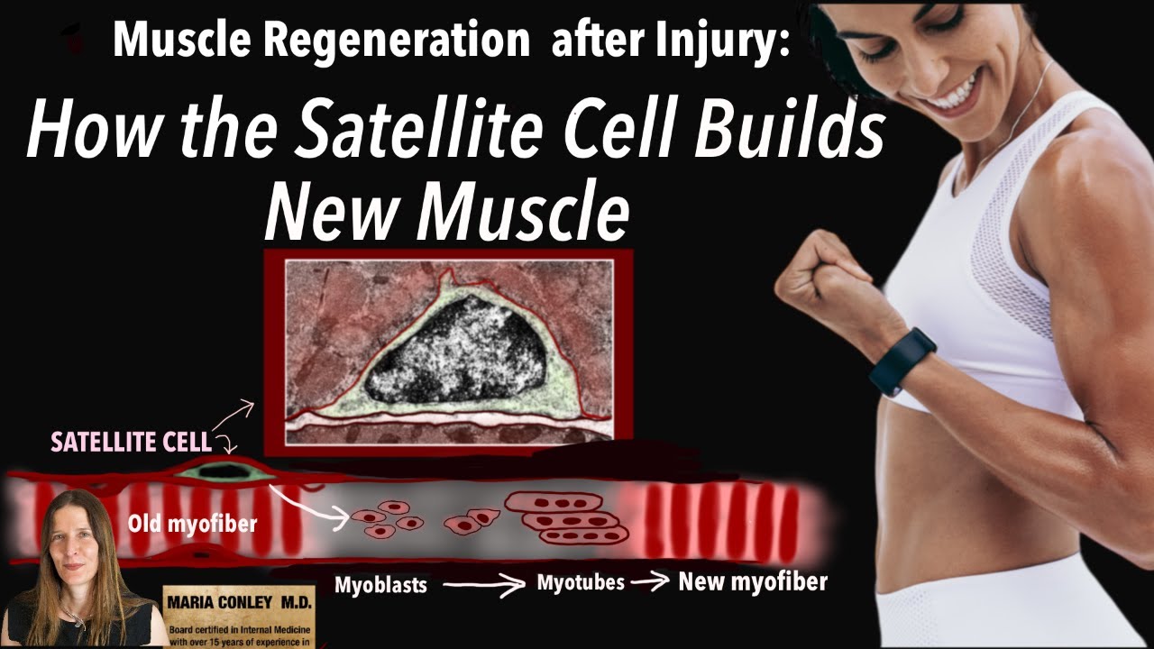Muscle Regeneration After Injury:  How the Satellite Cell Builds New Muscle