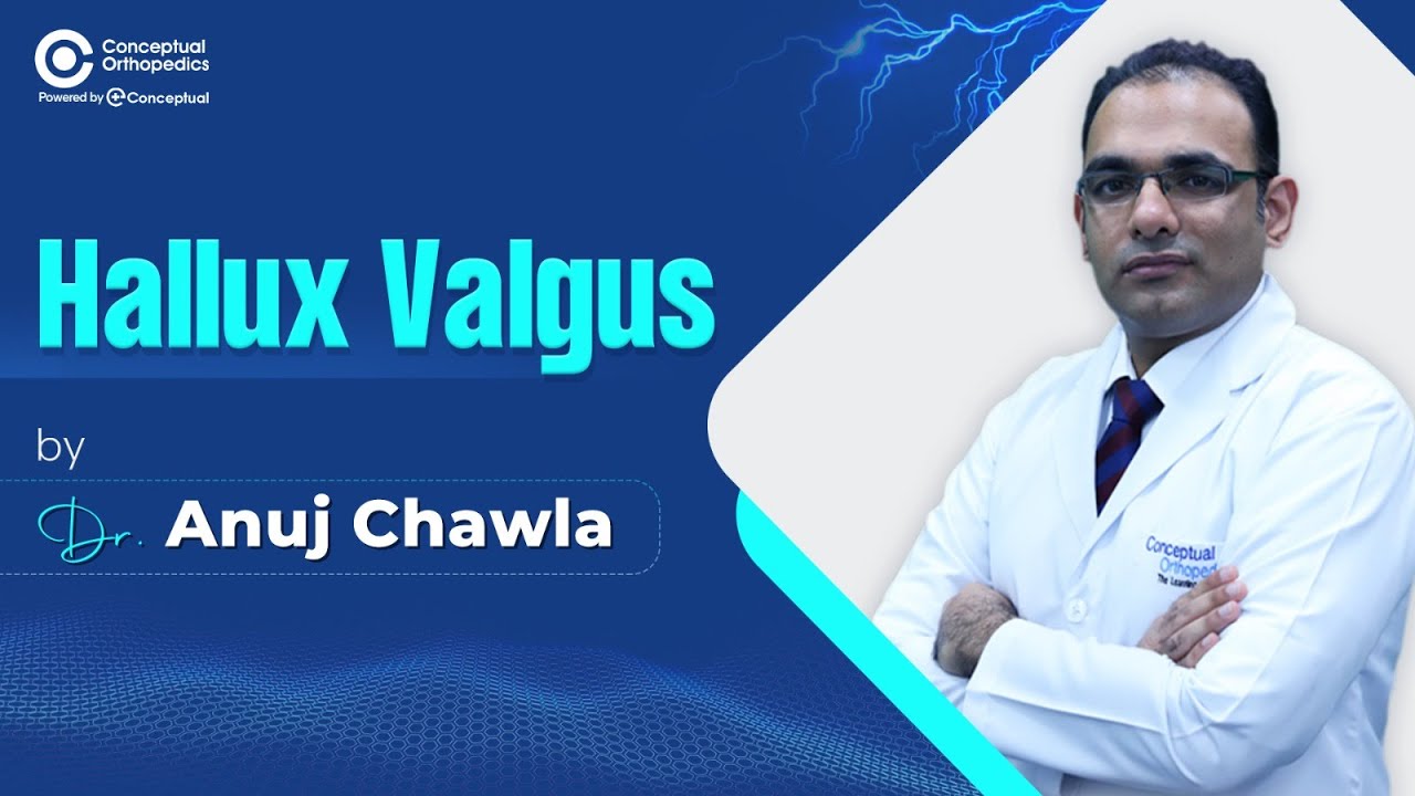 Hallux valgus Dr  Anuj Chawla W@ConceptualOrthopedics