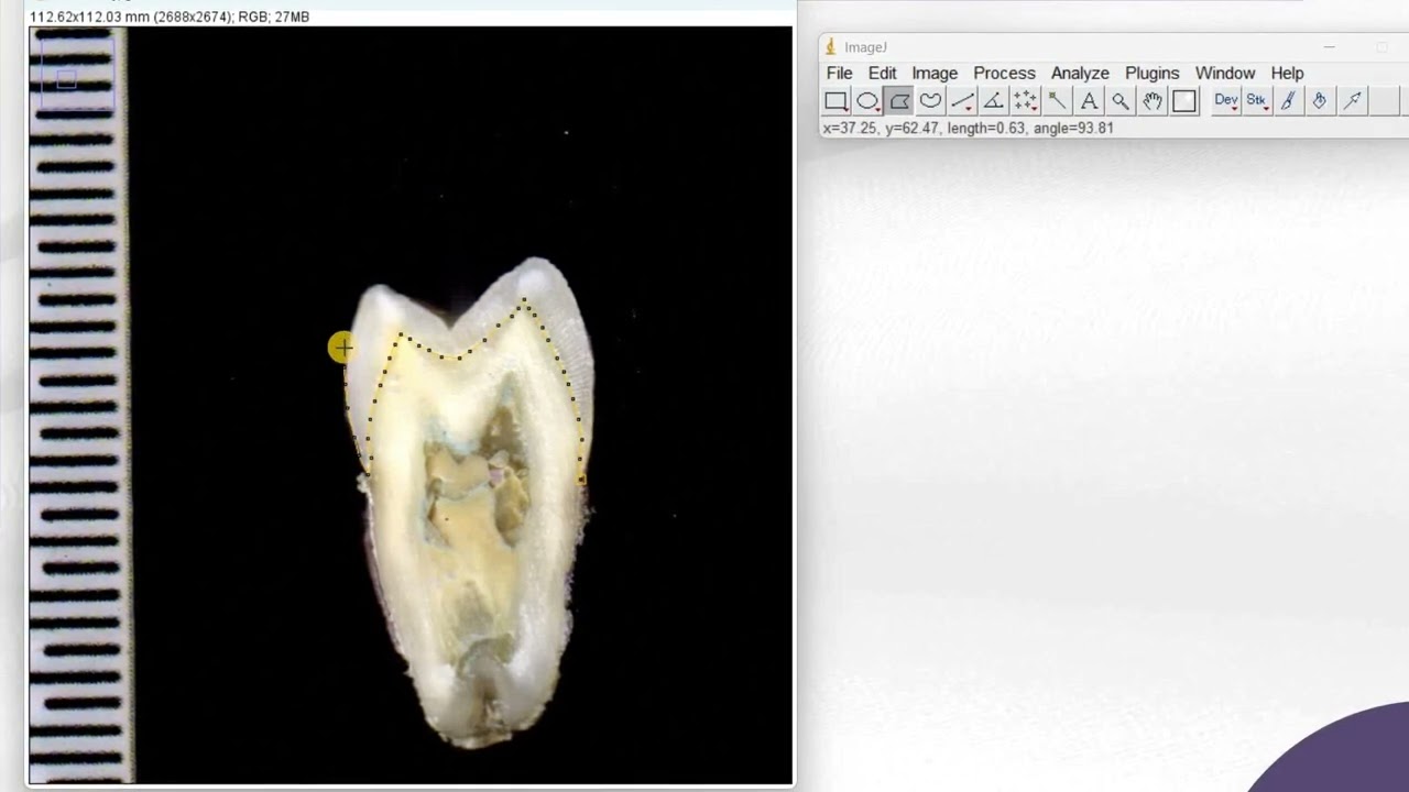 Image J: Using the polygonal selection tool