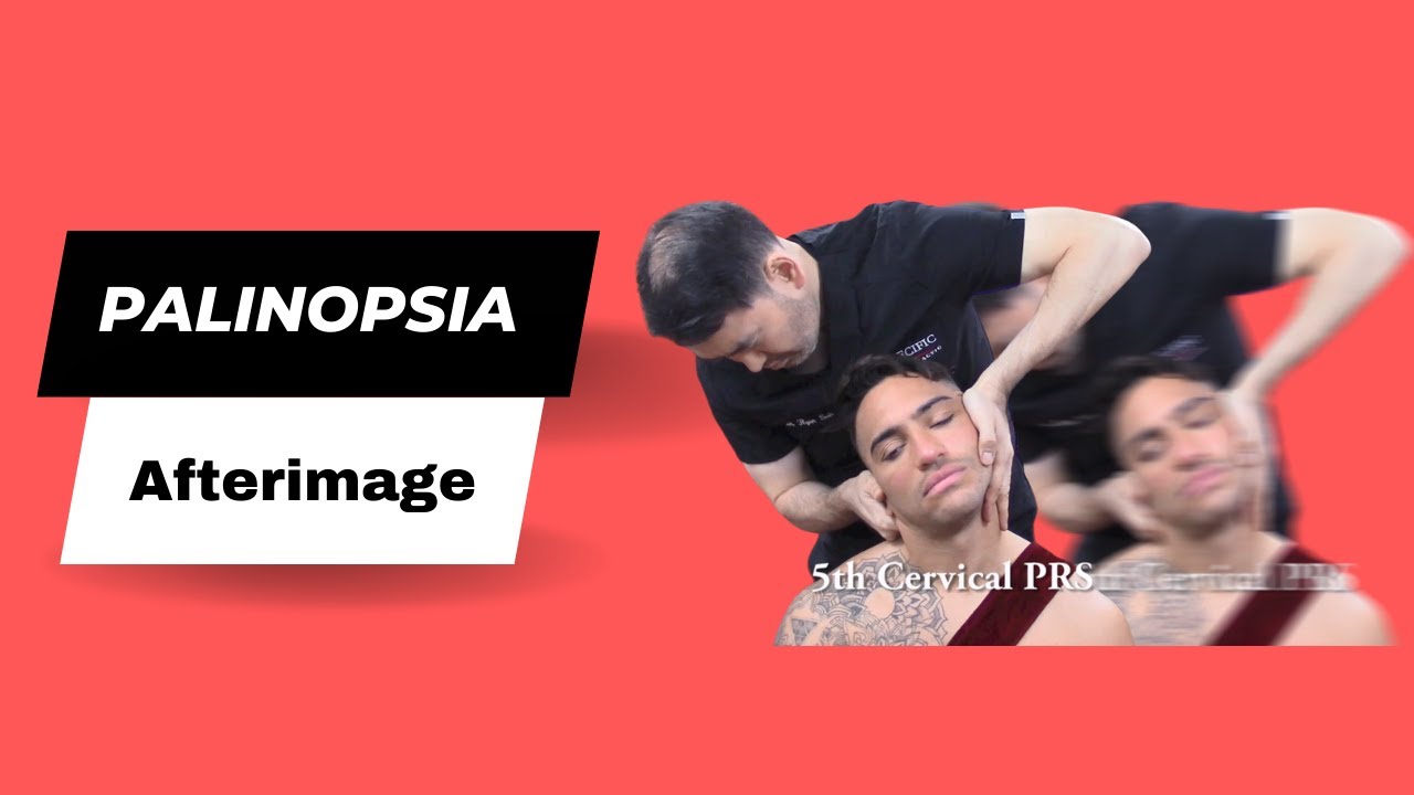 Palinopsia Treatment, Afterimage, Trailing image HELPED by Dr Suh