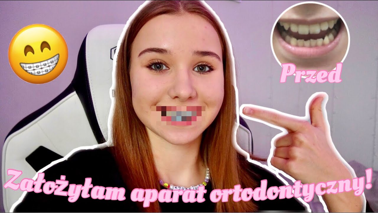 ZAŁOŻYŁAM APARAT NA ZĘBY, IZOTEK  I VLOG