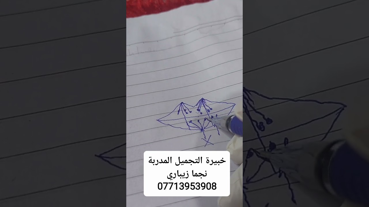 للمبتدئين .. بناءا لطلب من متابعةتكملة الفيديو السابق عن حقن الشفة التوضيحي .. تابعوا غوالي