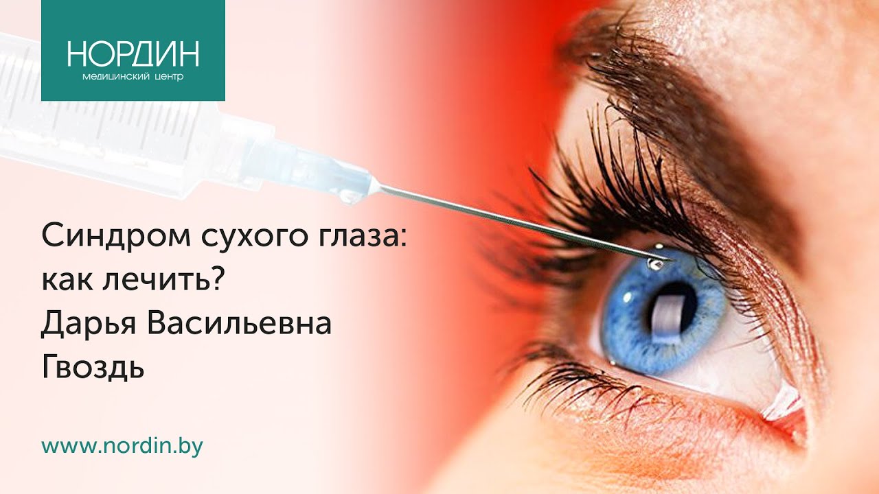 Синдром сухого глаза: как лечить?