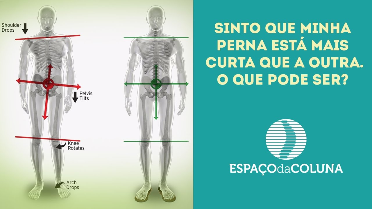 Sinto que minha perna está mais curta que a outra. O que pode ser?
