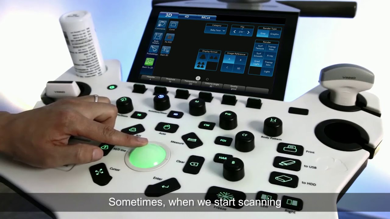 Vinno 4D Ultrasound Demo