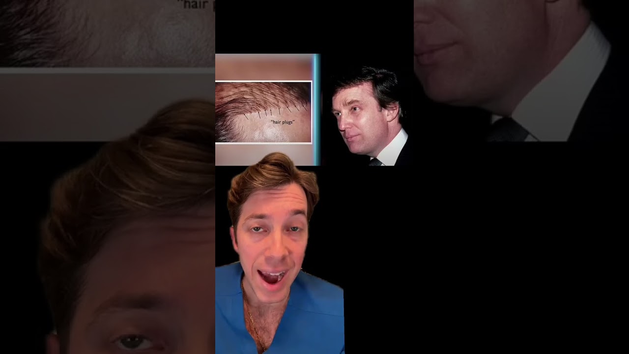 How Many Hair Transplants Has Donald Trump Had?