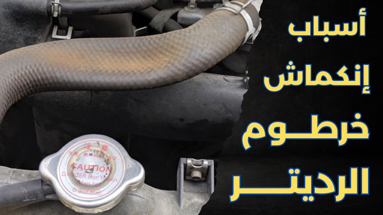 إنكماش خرطوم الرديتر | أشهر 3 أسباب