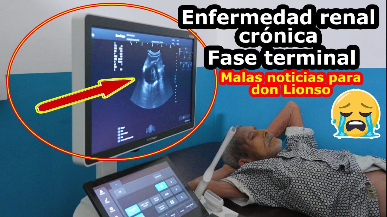 Última hora el doctor nos dio malas noticias con la salud de don Lionso vean que dijo - Ediciones M