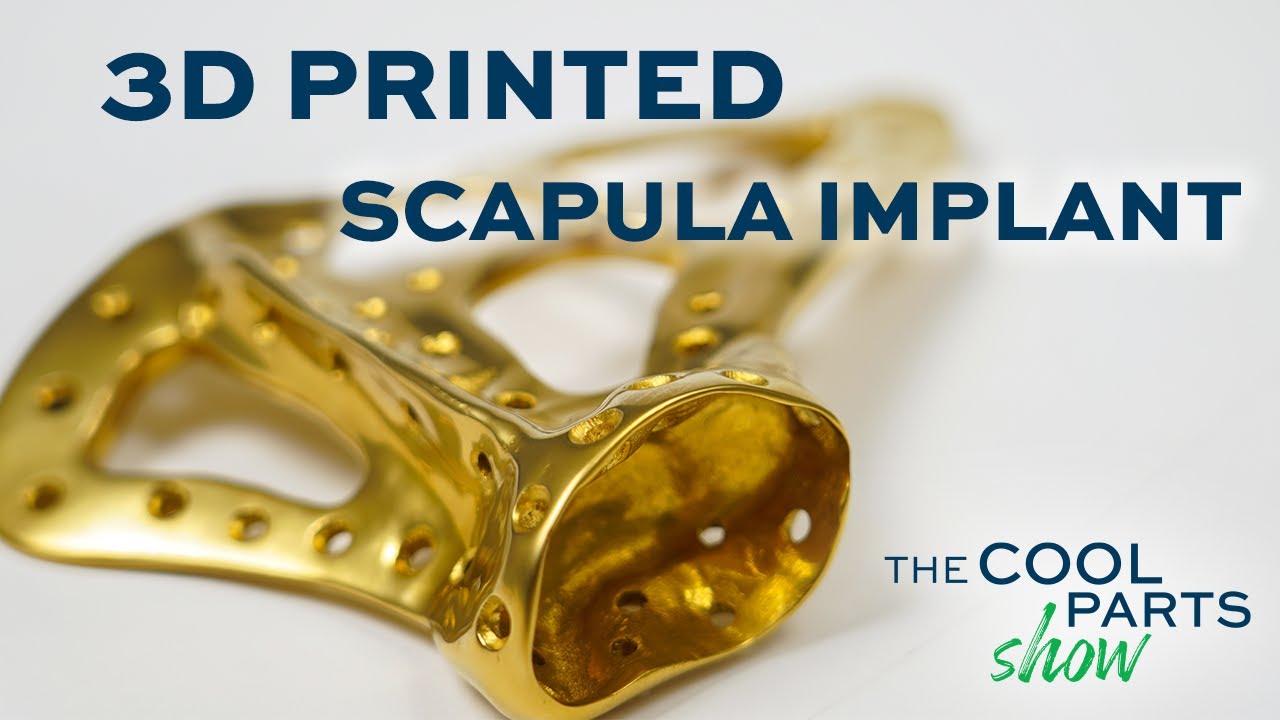 3D Printed Scapula Customized for Patient: The Cool Parts Show #25