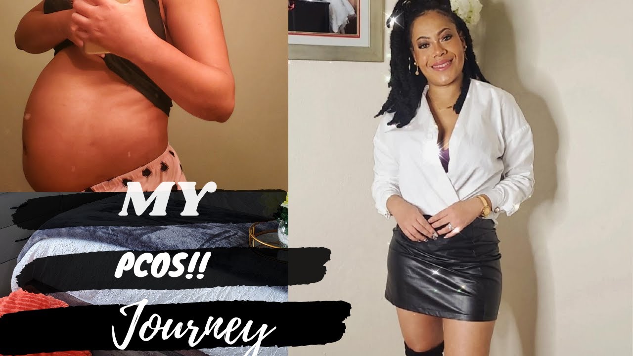 I HAVE PCOS PART 2! | INFERTILITY  | JOURNEY TO PREGNANCY