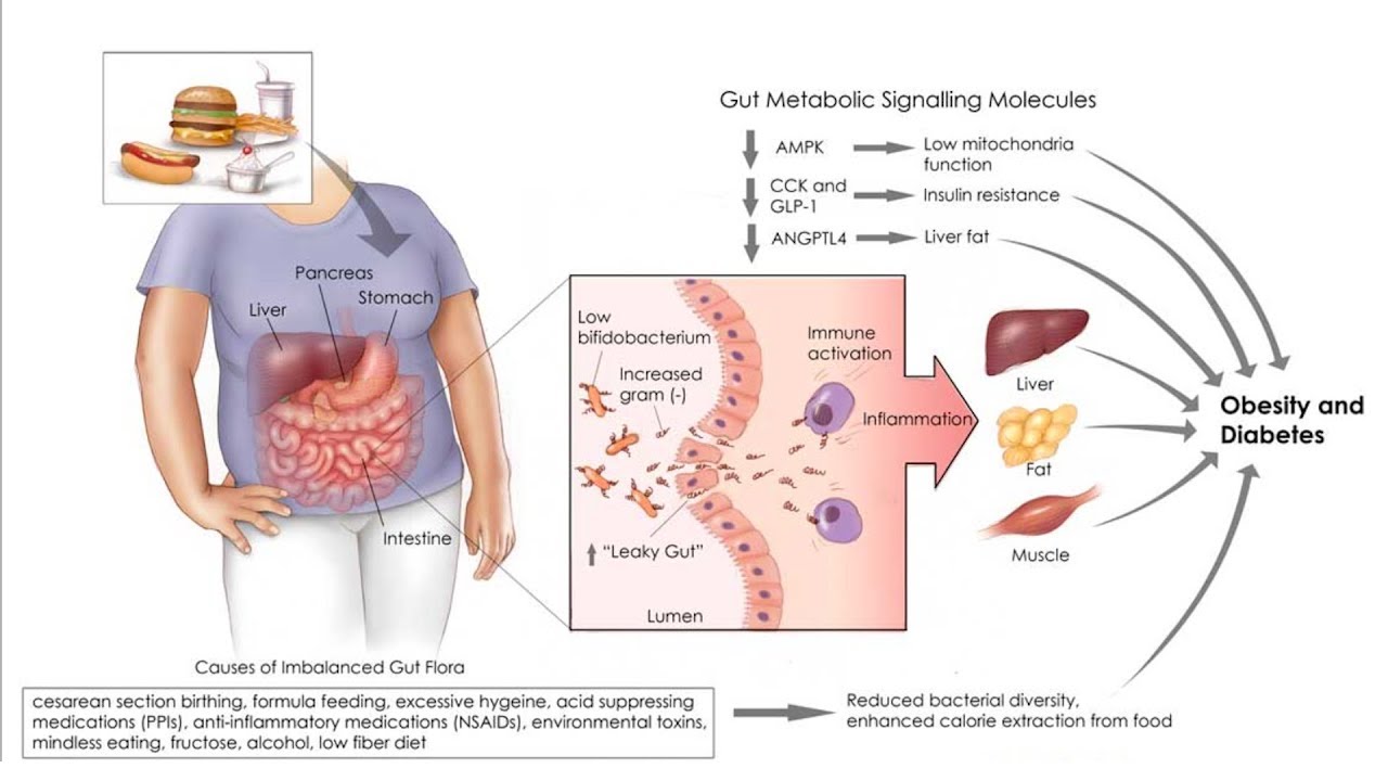 Ketogenic Diet, Endotoxin & Gut Health