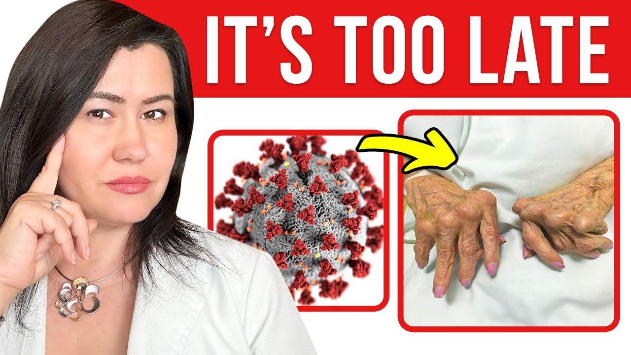 Can COVID-19 Causes Autoimmune Diseases? The TRUTH explained by a Rheumatologist