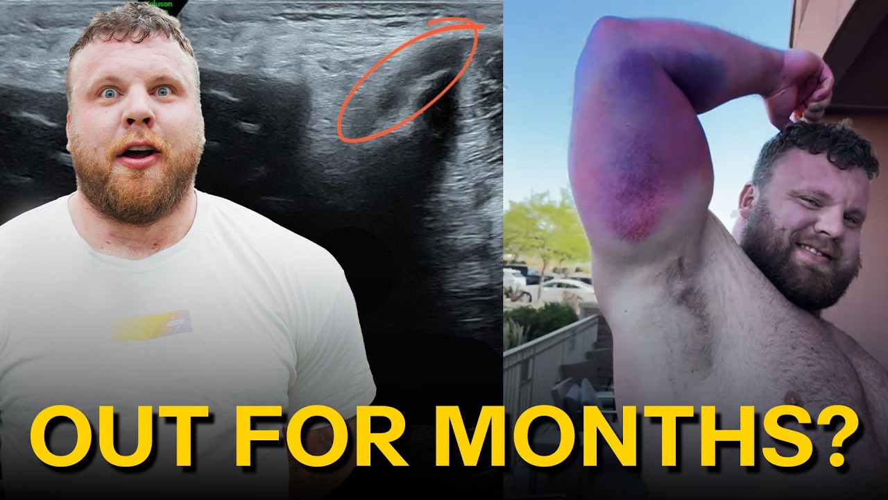 Strongest Man on Earth Tom Stoltman INJURY EXPLAINED 