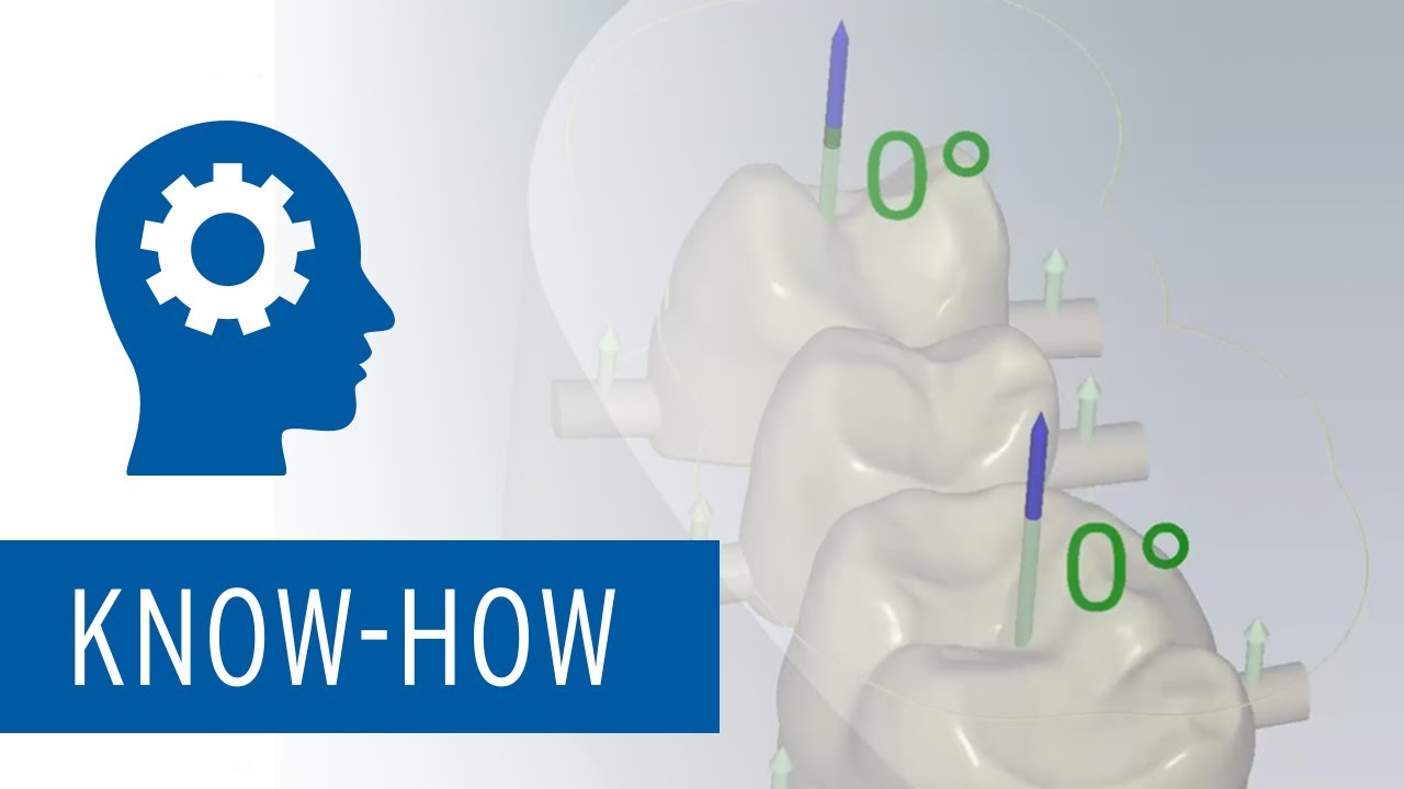 Ceramill Match 2 - New software design