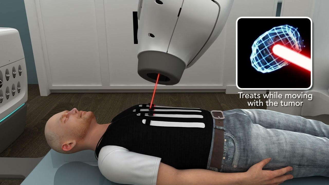 CyberKnife lung cancer treatment with precise radiation for patients @SpokaneCyberknife