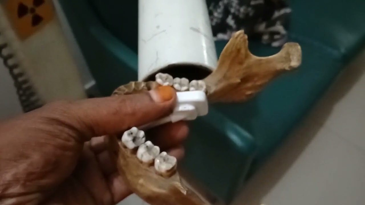 AX RAY FOLOR TO RVG DENTAL