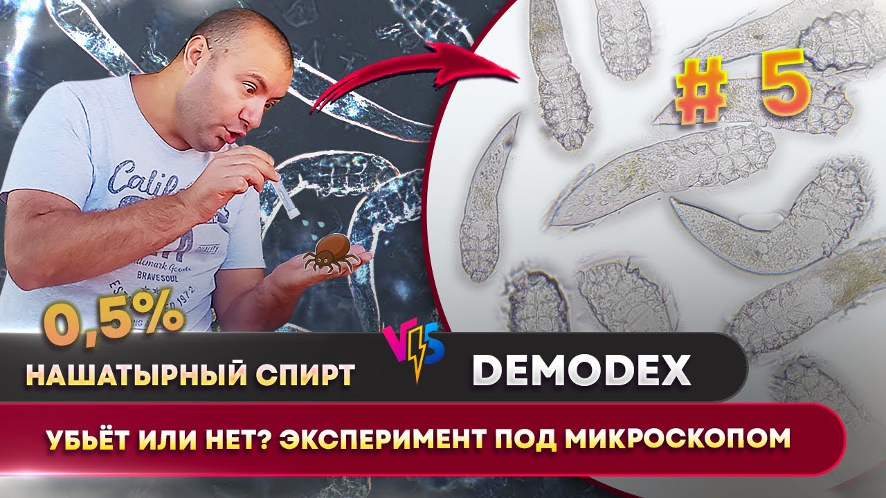 Нашатырный спирт 0,5% против клеща Демодекс 🕷️ | Убьёт или нет после 2 месяцев настаивания? #5