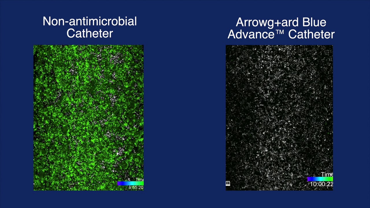 Arrowg+ard Blue Advance&trade; Protection Biofilm Formation Time Lapse Video