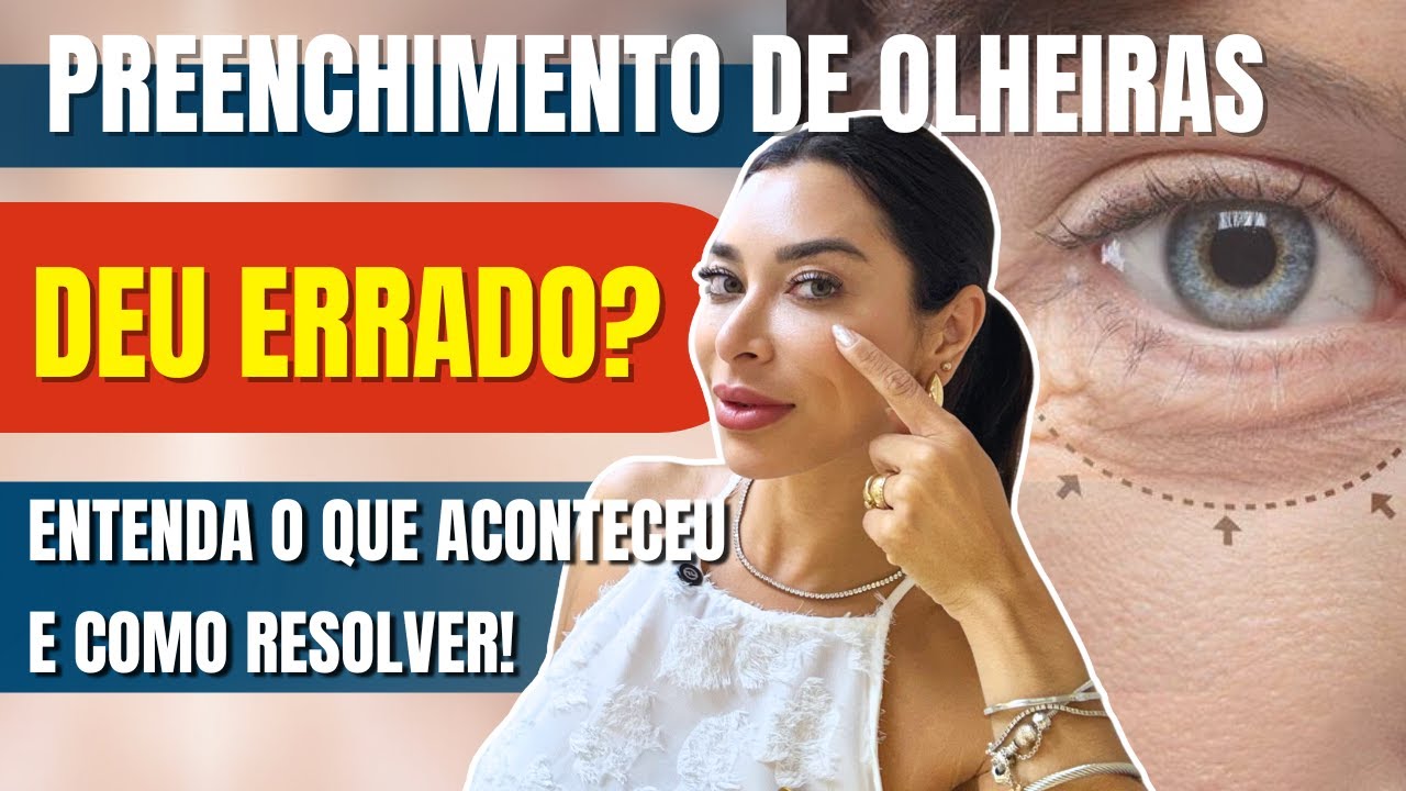 Preenchimento de Olheiras deu ERRADO? Entenda o que aconteceu e COMO resolver!