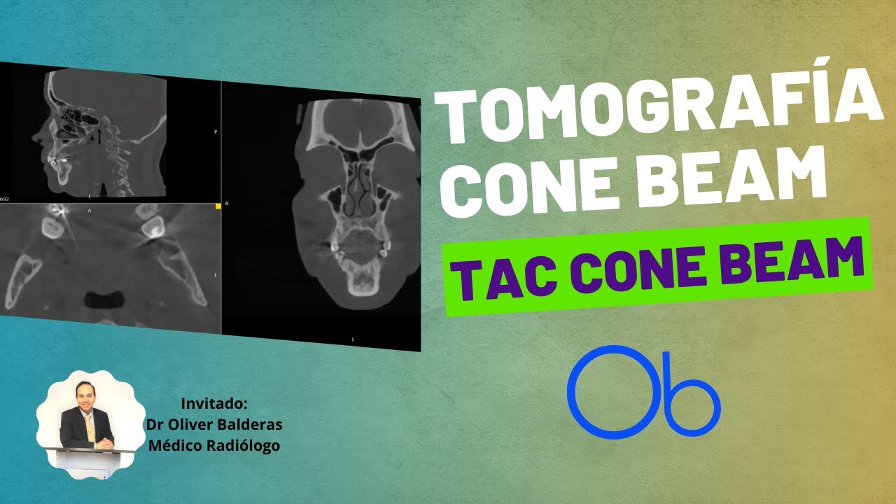 Tomografía Cone Beam 💀 TAC CONE BEAM