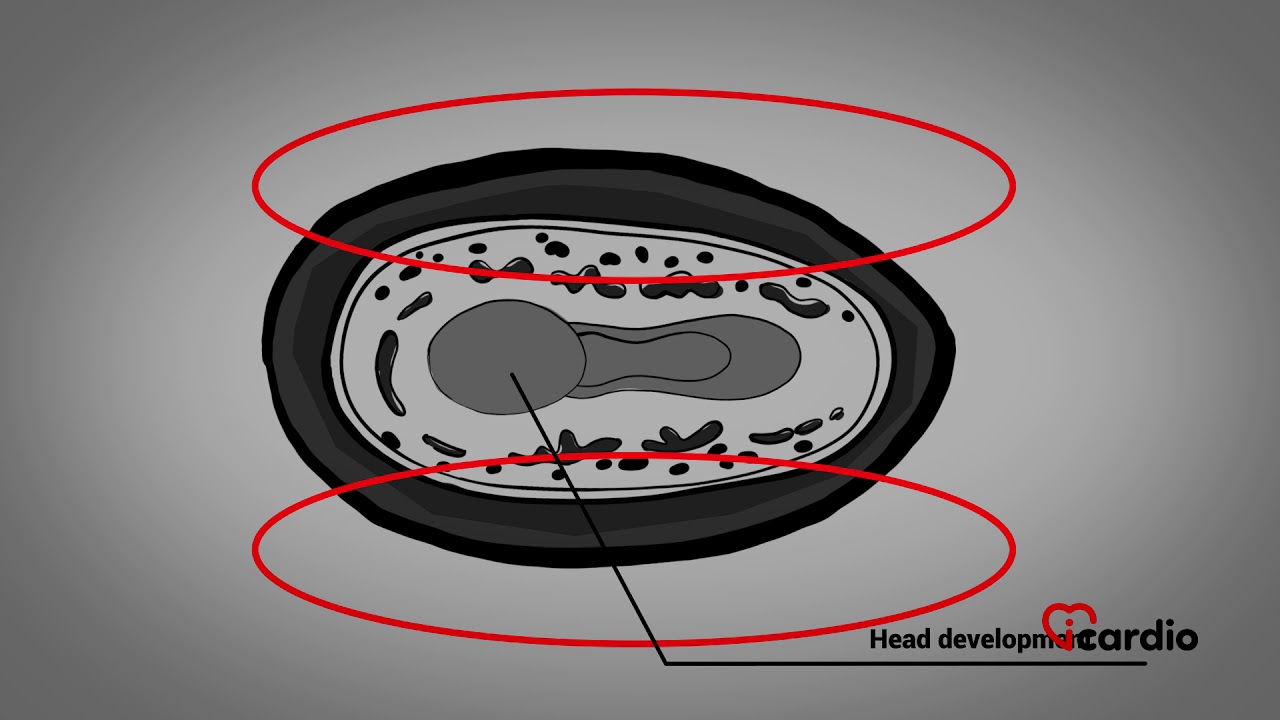 Development of the cardiovascular system