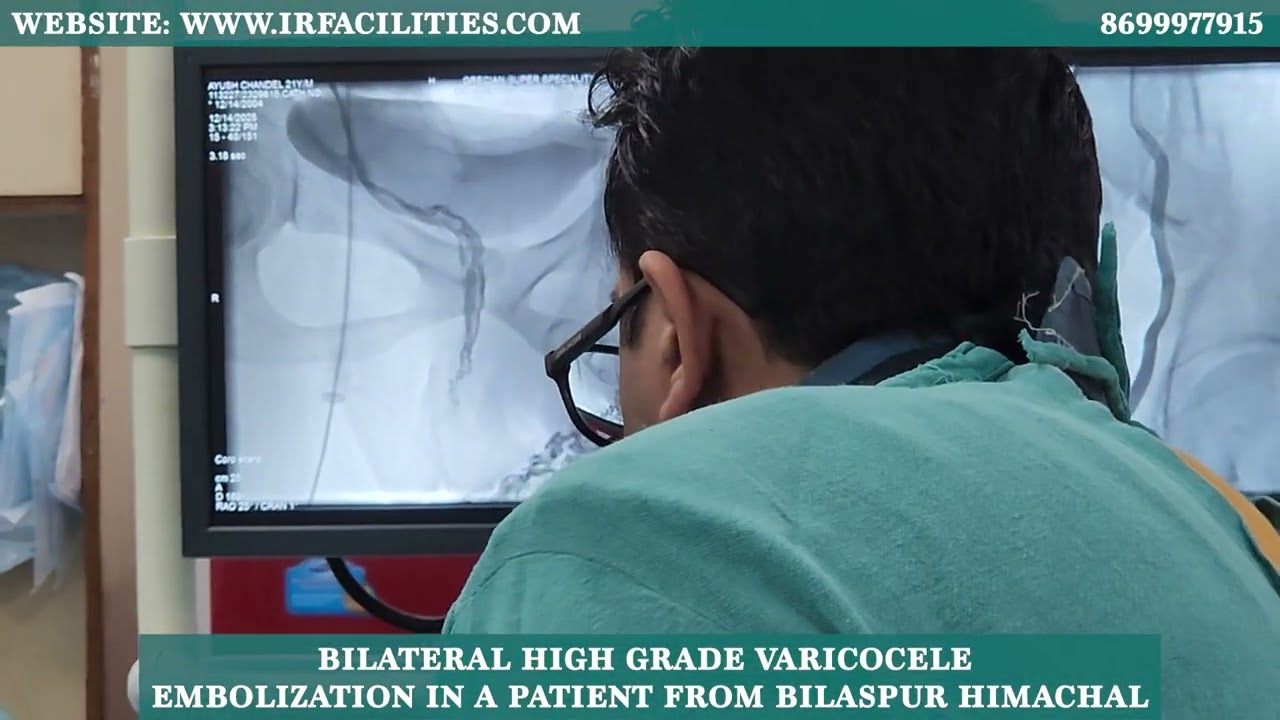 Bilateral High Grade Varicocele Embolization | Patient from Bilaspur Himachal | Dr. Sandeep Sharma