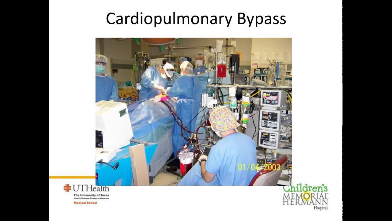 Congenital Heart Defects - Dr. Helena Gardiner & Dr. William Douglas