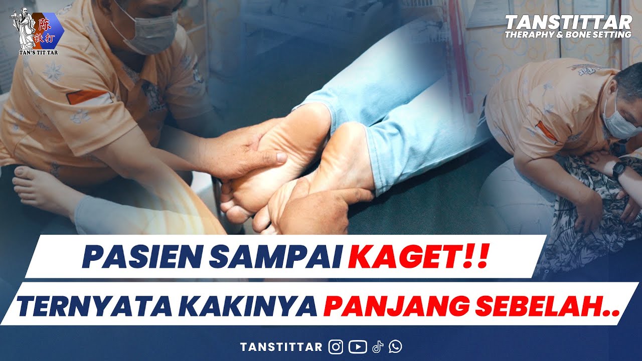 SAKIT PINGGANG SAMPAI PANGGUL!! TERNYATA KAKI PANJANG SEBELAH?!!