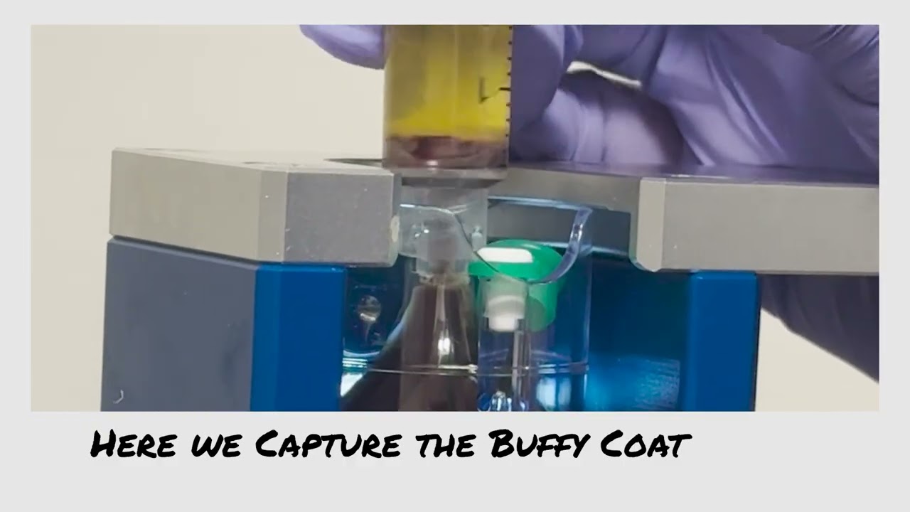 Buffy Coat PRP Explained