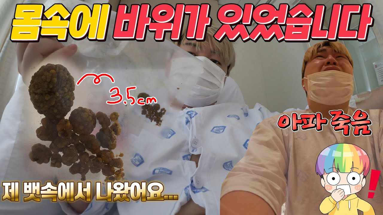 🚑수술했는데 몸속에서 초거대 돌이 나왔어요.... 🚑입원,수술 브이로그 - [김남욱]