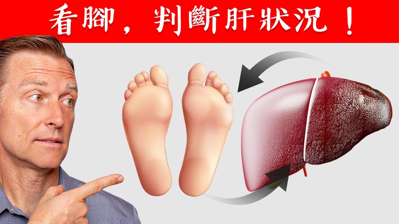 看腳皮膚,診斷肝臟：腳皮膚乾燥裂、灰指甲等，是肝有狀況？自然療法,柏格醫生 Dr Berg
