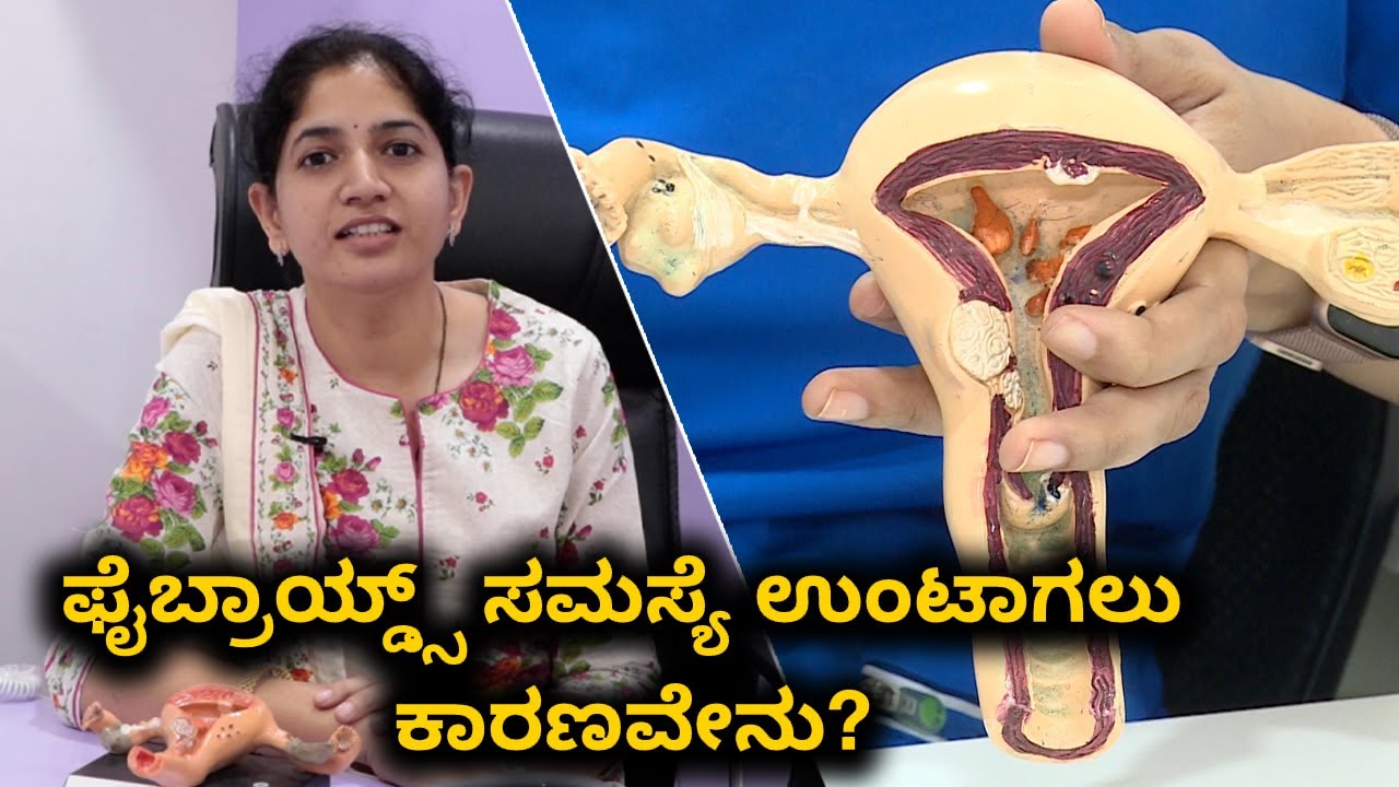 Fibroids: Types, Causes, and Symptoms | Vijay Karnataka