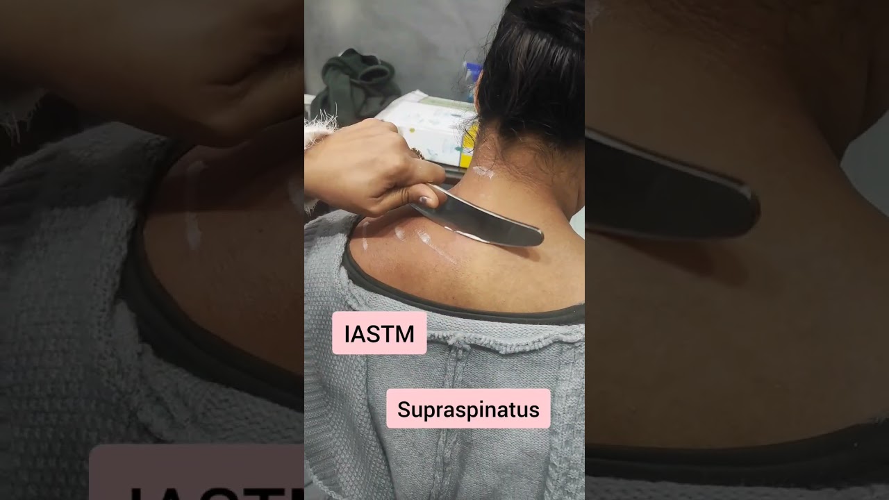 IASTM for Neck Pain and Stiffness #neckpain #iastm #youtube